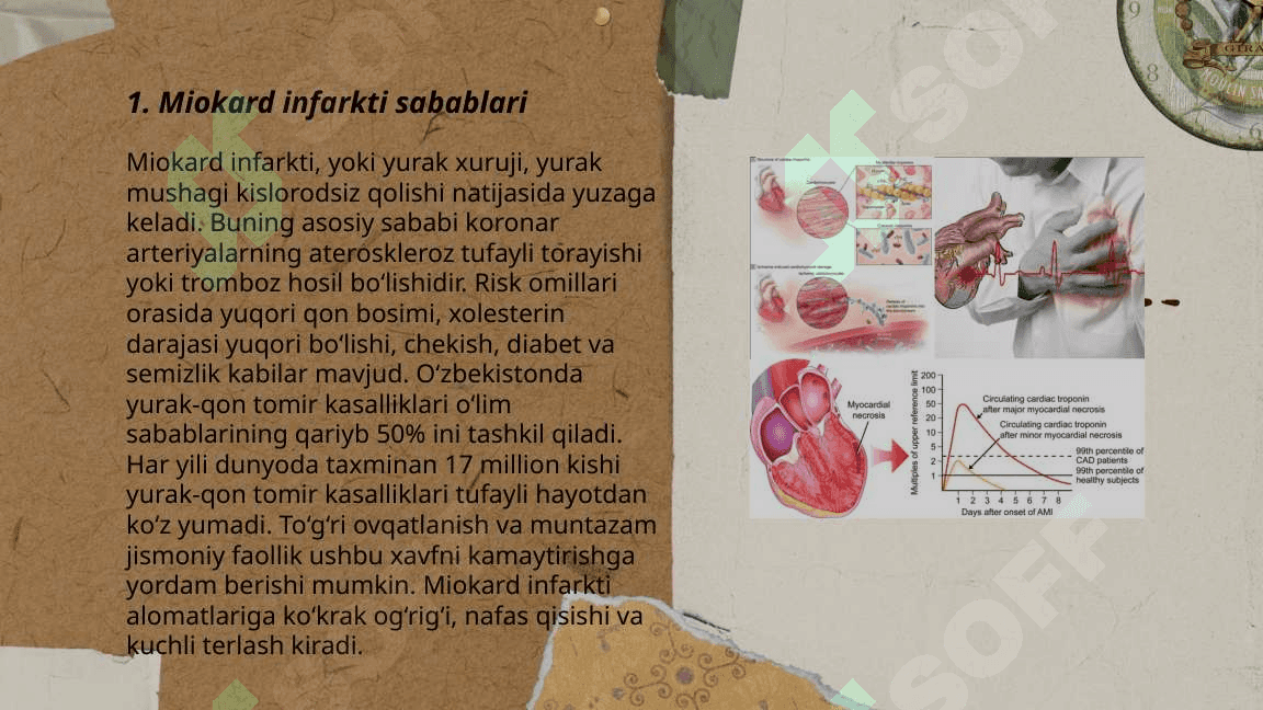 Miokard infarkti 2