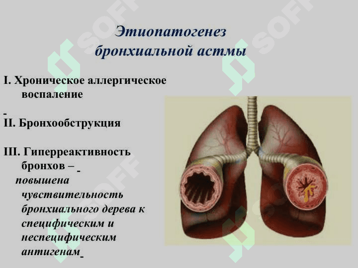 БРОНХИАЛ АСТМА  ЭТИОПАТОГЭНЕЗ  КЛИНИКА И ЛЕЧЕНИЕ 6