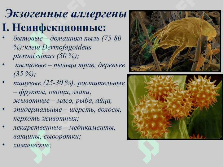 БРОНХИАЛ АСТМА  ЭТИОПАТОГЭНЕЗ  КЛИНИКА И ЛЕЧЕНИЕ 7