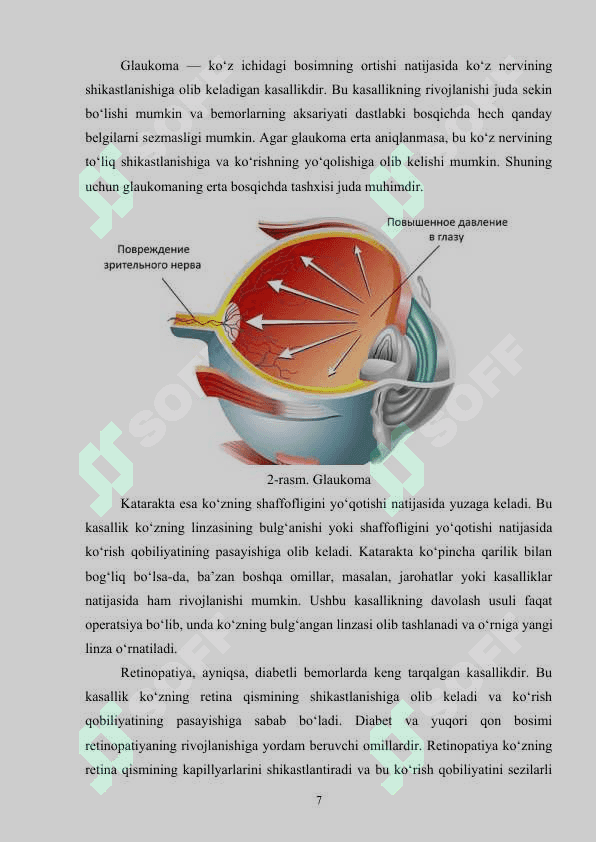 Sun’iy intellekt usullari yordamida ko‘z kasalliklarini aniqlash dasturini ishlab chiqish 7