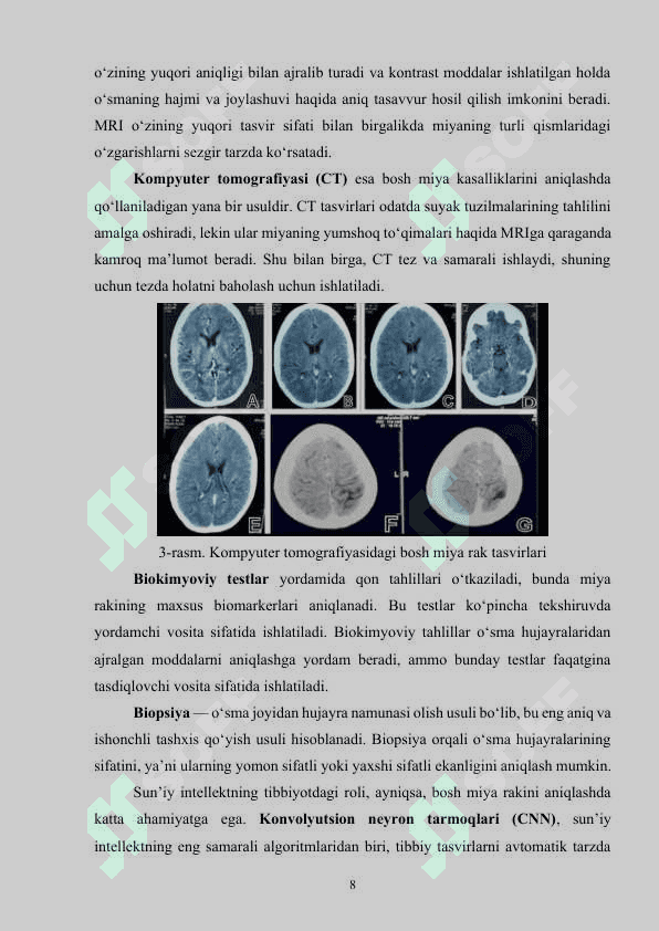 Sun’iy intellekt dasturiy vositalari asosida bosh miya rak kasalligini aniqlash dasturini ishlab chiqish 8