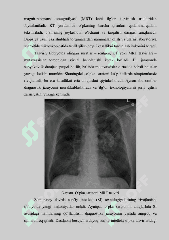 Neyron tarmoqlar asosida o‘pka saratoni kasalligini aniqlash dasturini ishlab chiqish 8