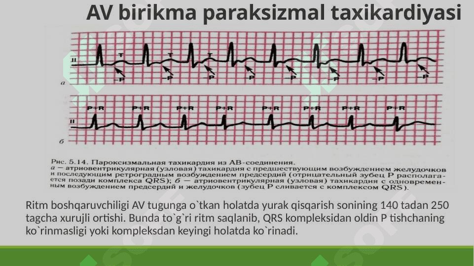 yurak aritmiyalarining ekg tasnifi va ko’rinishi 7