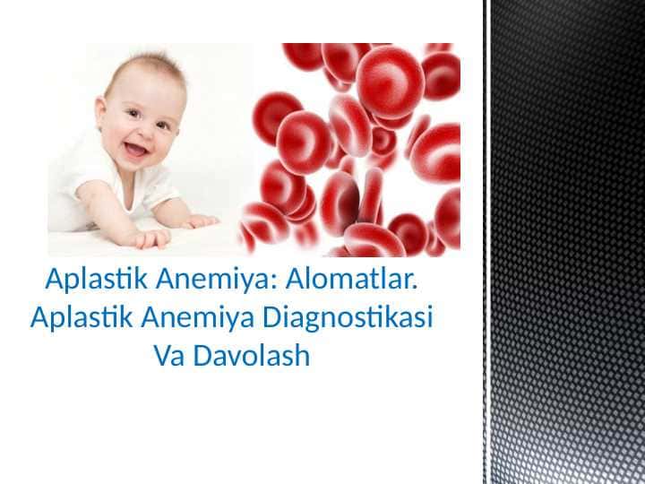 Aplastik Anemiya: Alomatlar. Aplastik Anemiya Diagnostikasi Va Davolash