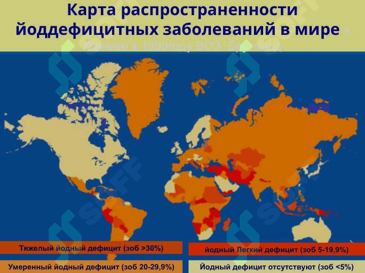 Йоддефицитные заболевания 3