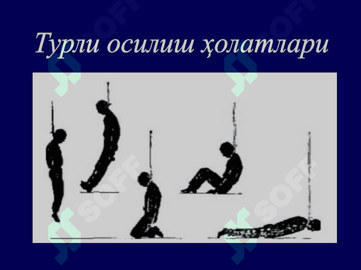 Механик асфиксия 7