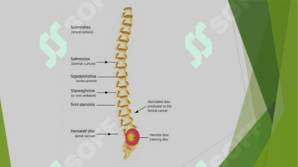 Umurtqa pog’onasi tug’ma anomaliyalari 6