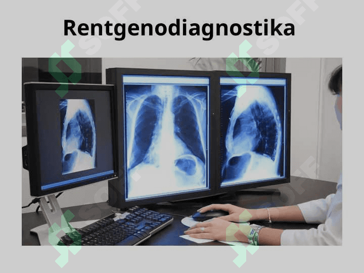 Zamanogoʻy rentgenologik tekseriw usullari . 7