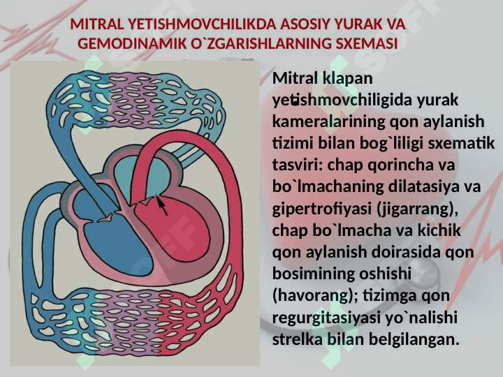 Yurak mitral va aortal nuqsonlari 7