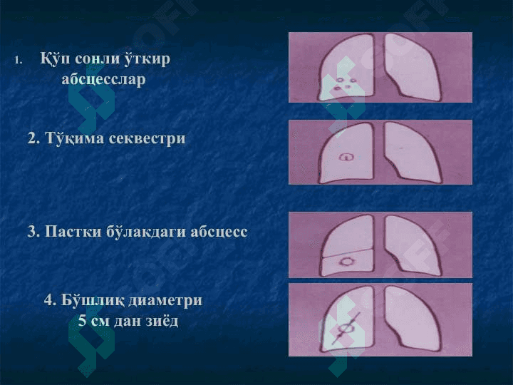 Ўпка сурункали носпецифик йирингли касалликлари 7