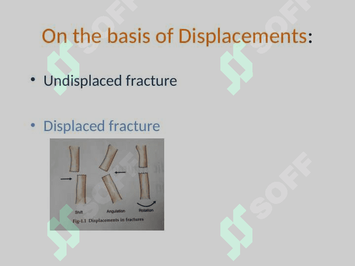 Fracture Management and Primary Care 8