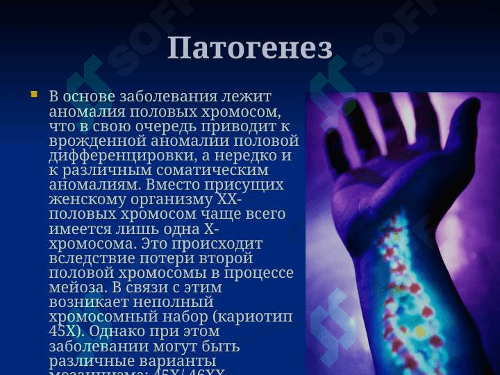 Синдром Шерешевского - Тернера 5