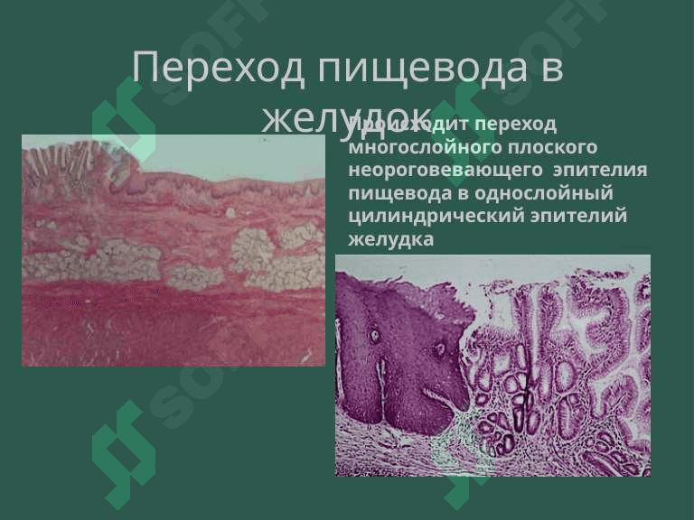 Пищеварительная система. Пищевода,желудок и кишечник. 8