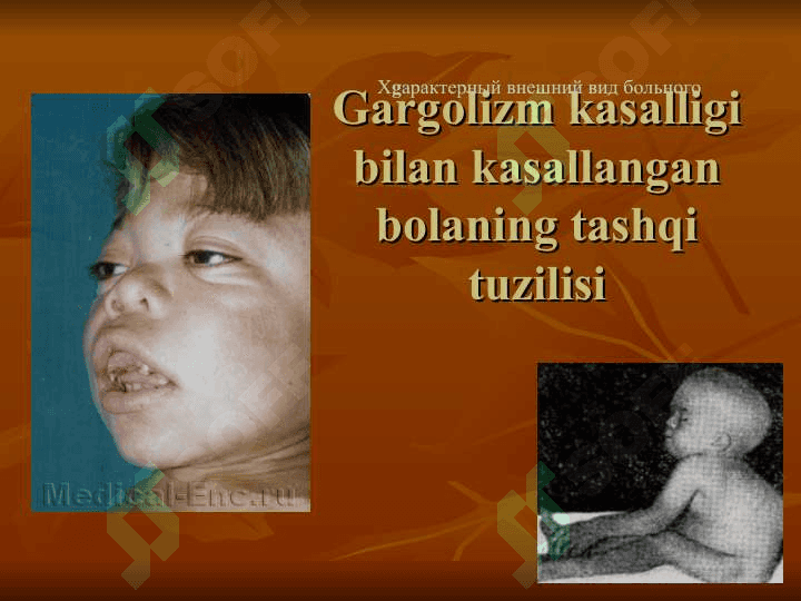 IRSIY KASALLIKLAR VA ULARNING OLDINI OLISH 6