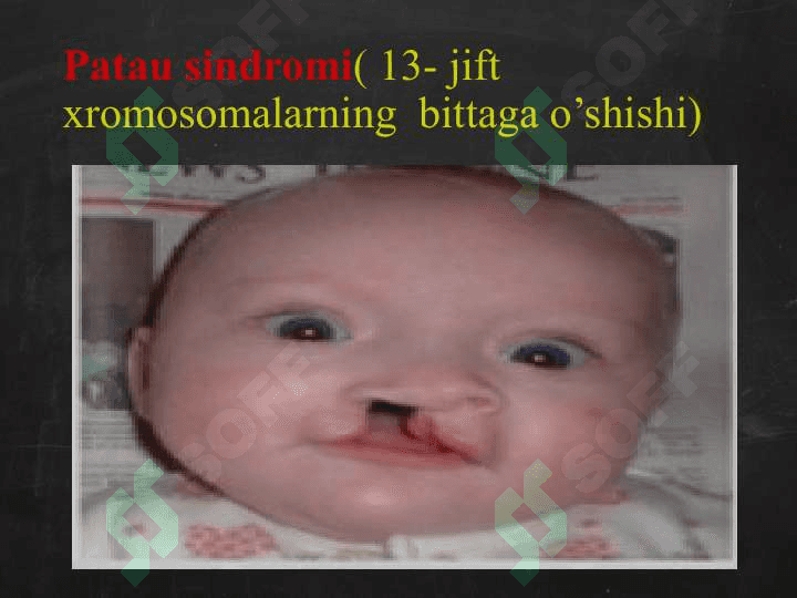 Genom mutatsiyalari: 8