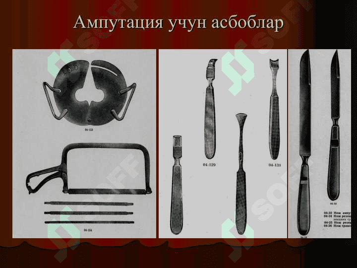 ҚЎЛ-ОЁҚДА АМПУТАЦИЯ ВА ЭКЗАРТИКУЛЯЦИЯЛАР 8