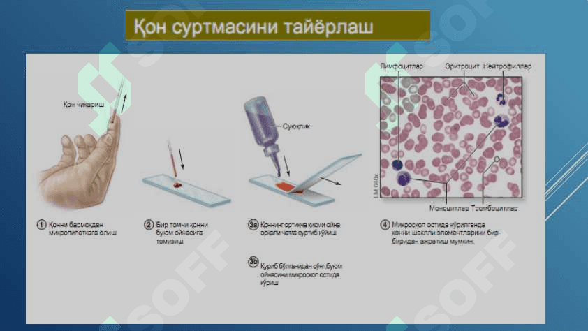 ҚОН ВА ҚОН ЯРАТИЛИШИ 5