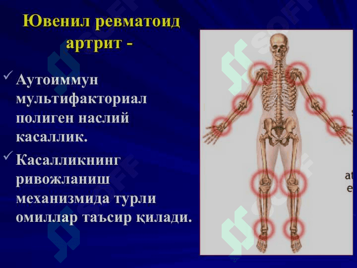 ЮВЕНИЛ  РЕВМАТОИД АРТРИТ 4