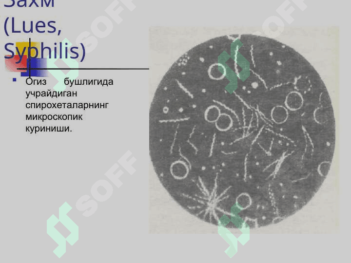 ЗАХМ (СИФИЛИС) Захм (Lues, Syphilis) 6