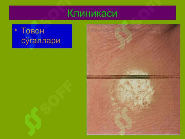 Терининг вирусли касалликлари 8