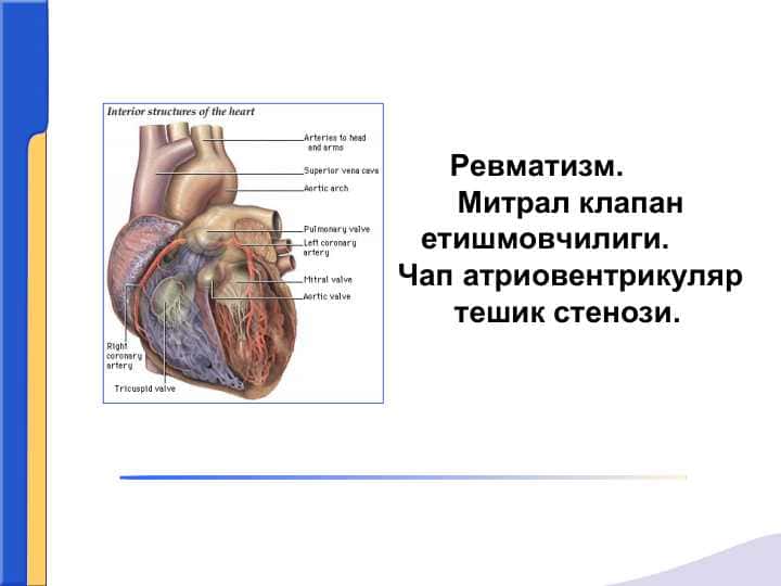 Ревматизм.         Митрал клапан етишмовчилиги.       Чап атриовентрикуляр тешик стенози.