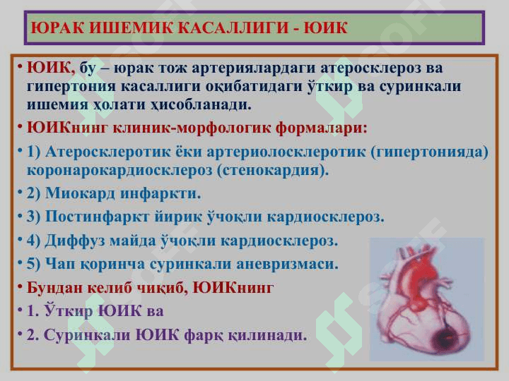 “Юрак ишемик касаллиги. Цереброваскуляр касаллик” 3