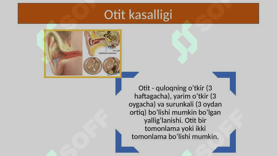 O’tkir va surunkali otit 15.pptx 3