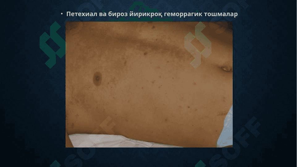 GEMORRAGIK ISITMA 8