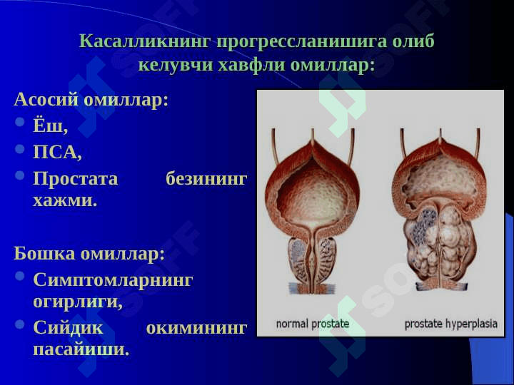 ПРОСТАТА БЕЗИ ХАВФСИЗ ГИПЕРПЛАЗИЯСИ 6