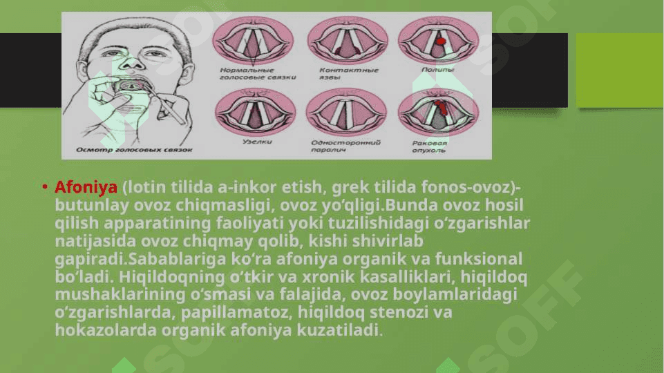 NUTQIDA NUQSONI BO’LGAN BOLALAR 4