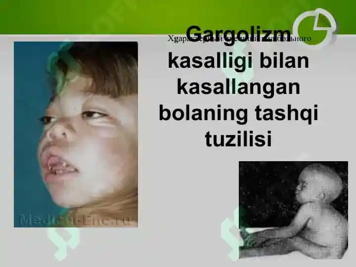Irsiy kasalliklar va ularning oldini olish 6
