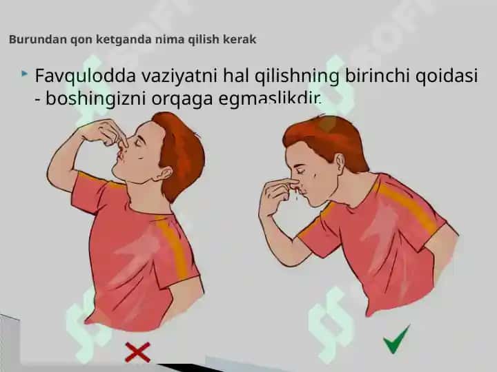 LOR a’zolarida qon ketish Mahalliy gemostaz uchun pereparatlar 5