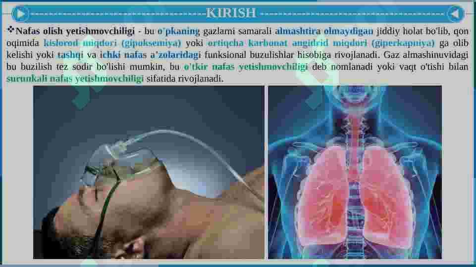 O'TKIR VA SURUNKALI NAFAS YETISHMOVCHILIGI 3