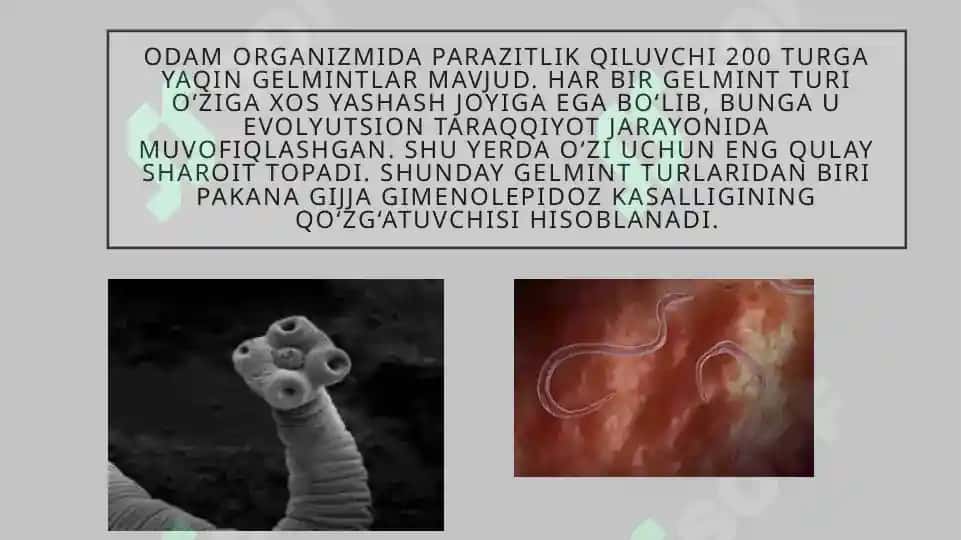 Gijjalar haqida umumiy ma'lumot. "Pakana gijja" 2