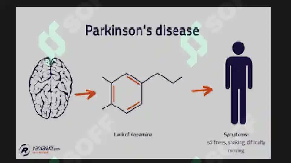 Parkinson kasalligini davolashda qo'llaniladigan dori vositalari 8