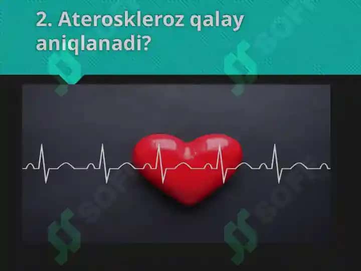 Ateroskleroz rivojlanishi 3