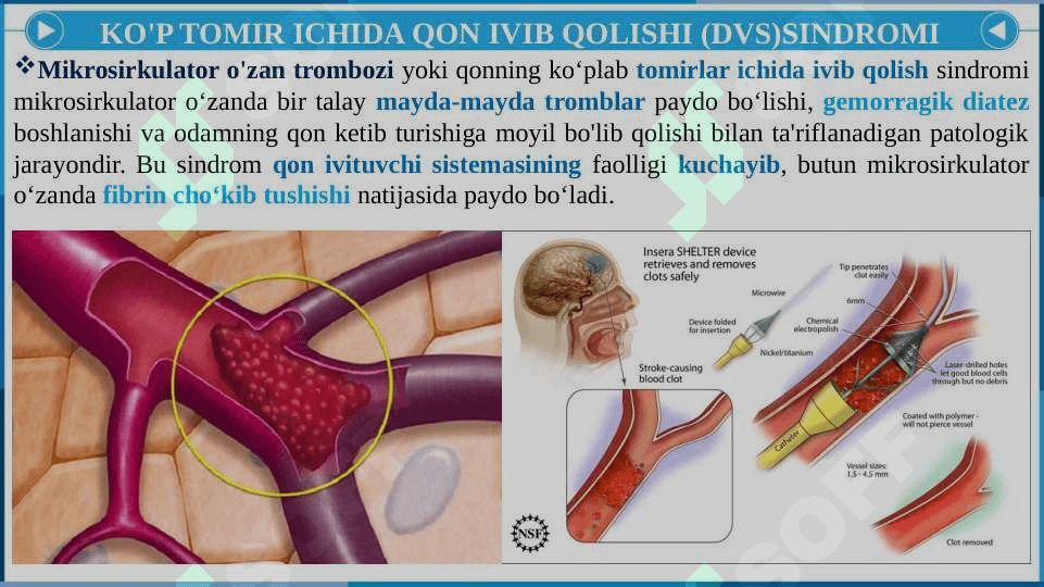 DISSEMINIRLANGAN TOMIRICHI IVISHI 3