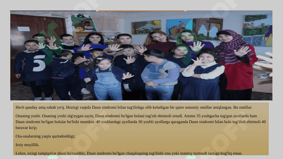 Daun sindromi Daun sindromi  Kelib chiqish sabablari  Kasallik belgilari 4
