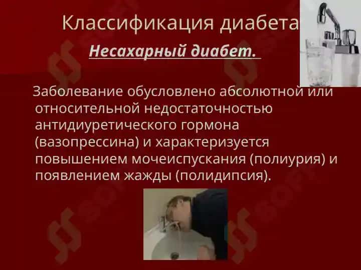 Сахарный диабет 4