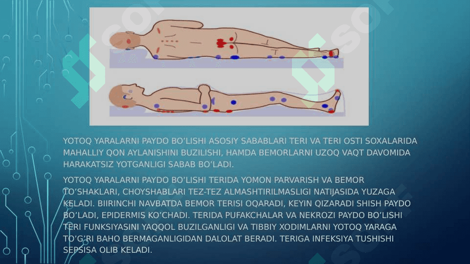 BOLALARDA YOTOQ YARALARINI OLDINI OLISH 4