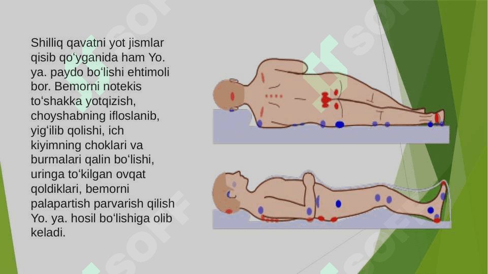 BOLALARDA YOTOQ YARALARNI OLDINI OLISH 3