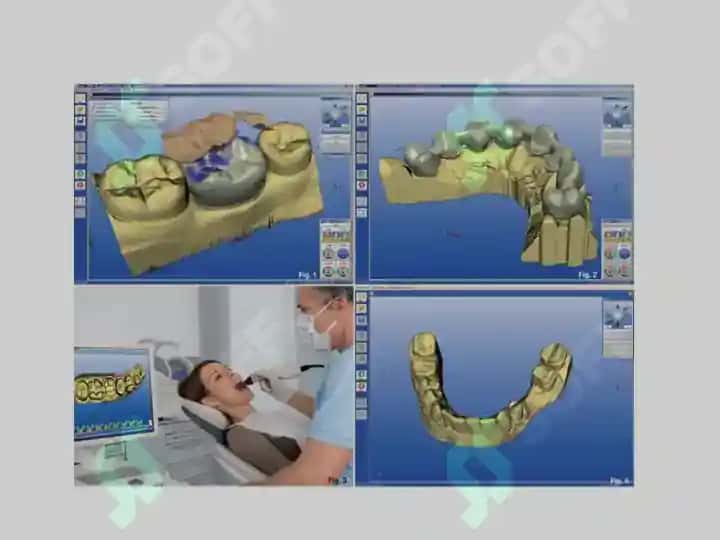 Dioksid tsirkon. CAD-CAM tizimi 8