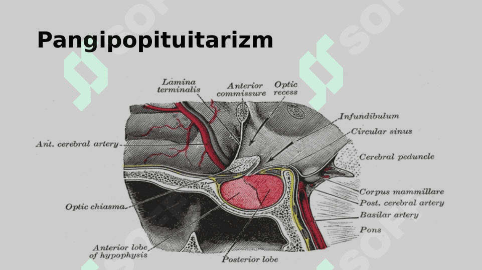 PANGIPOPITUITARIZM 4