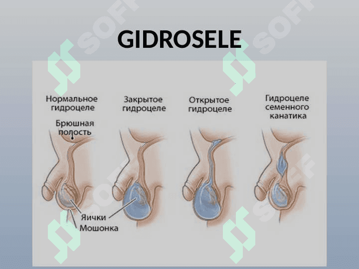 ERKAKLAR VA AYOLLAR TANOSIL A`ZOLARI KASALLIKLARI 3