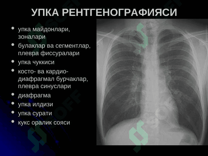 Упка касалликларининг нур ташхиси 4