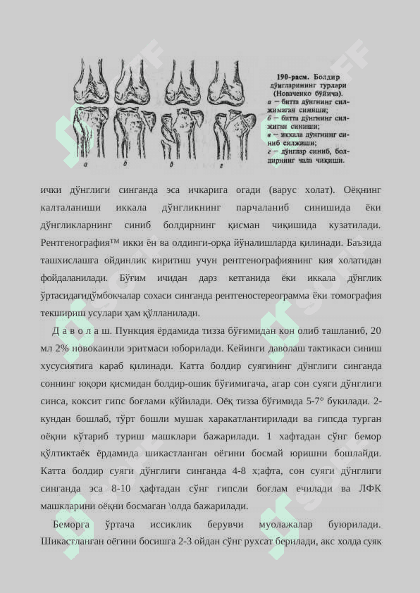 СОН  ВА   КАТТА   БОЛДИР   СУЯКЛАРИ ДЎНГЛИКЛАРИНИНГ БЎҒИМ  ИЧИДАН   СИНИШИ 4