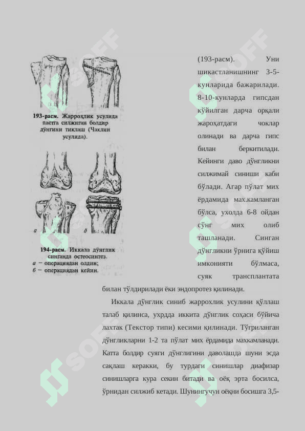 СОН  ВА   КАТТА   БОЛДИР   СУЯКЛАРИ ДЎНГЛИКЛАРИНИНГ БЎҒИМ  ИЧИДАН   СИНИШИ 8