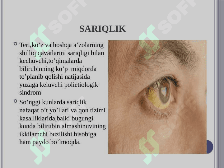 Sariqlik 2