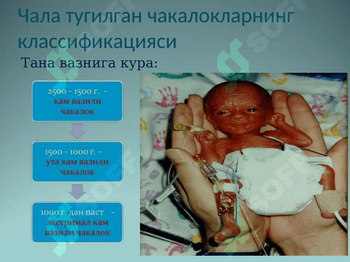 Чала тугилган чакалоклар 4
