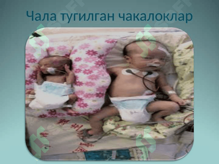 Чала тугилган чакалоклар 5